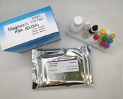 Antígeno Elisa Home Test Kit de la base del virus de la hepatitis B 96 pedazos de la eficacia alta