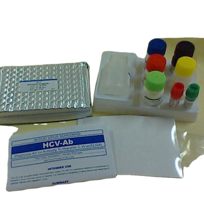 Interleukin 1 equipo beta Il1b humano Elisa Kit Reaserch Use de la detección del elisa